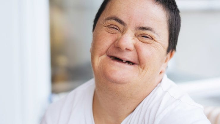 An elderly person with Down syndrome.